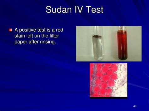 sudan iv test for|sudan iv test positive color.